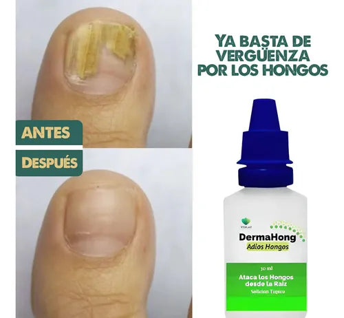 Mágico DermaHong